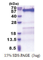 VPS4B (1-444, His-tag) Human Protein