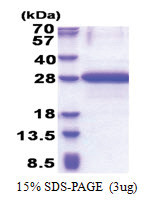 OBFC2A (1-204, His-tag) Human Protein