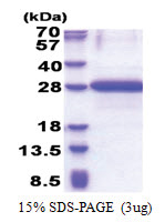 OBFC2A (1-204, His-tag) Human Protein