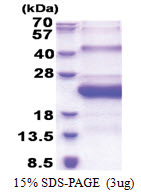 SMCP (1-116, His-tag) Human Protein
