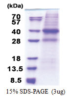 CAPZA2 (1-286, His-tag) Human Protein