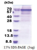 DDX56 (1-547, His-tag) Human Protein