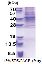 PAX9 (1-341, His-tag) Human Protein