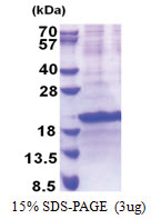 SIVA1 / SIVA (1-175, His-tag) Human Protein