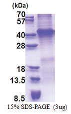 WNT7A (32-349, His-tag) Human Protein