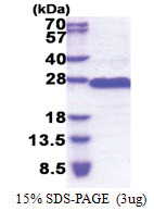 GAGE2D (1-116, His-tag) Human Protein