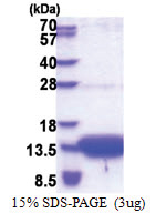 SLC51B (57-128, His-tag) Human Protein