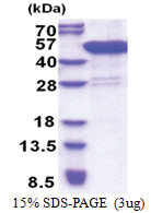 CCDC104 (1-342, His-tag) Human Protein
