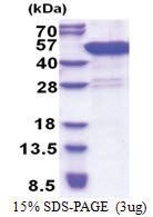 CCDC104 (1-342, His-tag) Human Protein