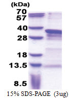 PRRX1 (1-217, His-tag) Human Protein
