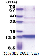 SERF2 (1-59, His-tag) Human Protein