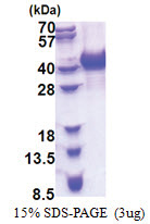 hnRNP-A/B / HNRNPAB (1-285, His-tag) Human Protein