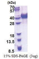 hnRNP-A/B / HNRNPAB (1-285, His-tag) Human Protein