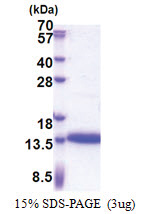 Cysteine-rich protein 1 (1-77, His-tag) Human Protein