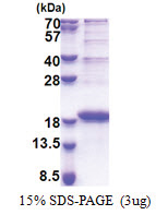 LBH (1-105, His-tag) Human Protein