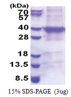 UBE2R2 (1-238, His-tag) Human Protein