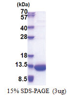 LSM5 (1-91, His-tag) Human Protein