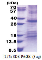 CHCHD3 (1-227, His-tag) Human Protein