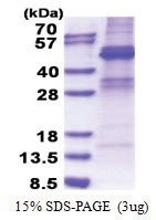 ZNF514 (1-400, His-tag) Human Protein