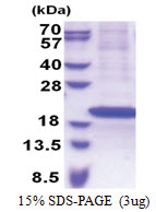 RPS18 (1-152, His-tag) Human Protein