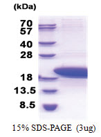 Parathymosin / PTMS (1-102, His-tag) Human Protein