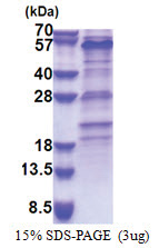 ZNF689 (1-500, His-tag) Human Protein