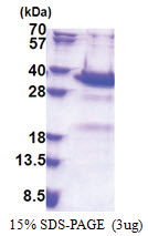 Synaptotagmin-5 (109-386, His-tag) Human Protein