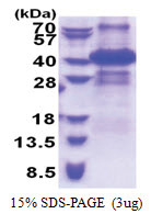 ING2 / ING1L (1-280, His-tag) Human Protein