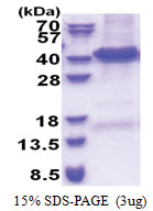 EIF3I / EIF3S2 (1-325, His-tag) Human Protein
