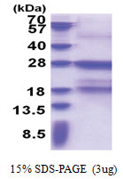FCER1A (26-205, His-tag) Human Protein