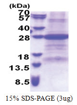 FAIM (1-213, His-tag) Human Protein