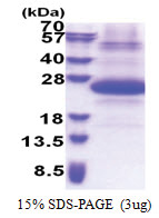SSSCA1 (1-199, His-tag) Human Protein