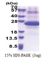 SSSCA1 (1-199, His-tag) Human Protein