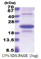 EDA2R / TNFRSF27 (1-138, His-tag) Human Protein