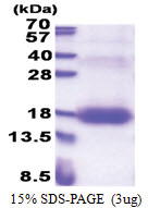ZNRD1 (1-126, His-tag) Human Protein