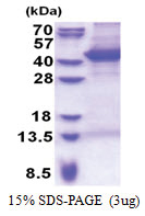 MOAP1 (1-351, His-tag) Human Protein