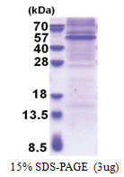 RAPSN / RNF205 (1-412, His-tag) Mouse Protein