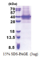 PIH1D1 (1-290, His-tag) Human Protein
