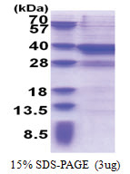 MPPED2 (1-294, His-tag) Human Protein