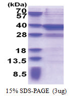 MPPED2 (1-294, His-tag) Human Protein