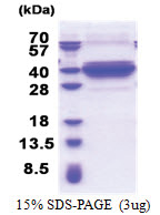 DNALI1 (1-280, His-tag) Human Protein
