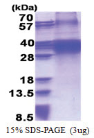FHL3 (1-280, His-tag) Human Protein