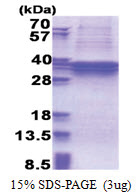TBC1D1 (1-265, His-tag) Human Protein