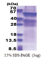 UGT8 / UGT4 (21-541, His-tag) Human Protein
