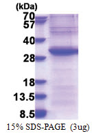EXOSC4 (1-245, His-tag) Human Protein