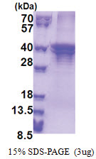 ST3GAL5 (83-418, His-tag) Human Protein