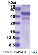 RFI / RNF34 (1-373, His-tag) Human Protein