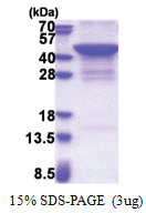 JMJD7 (1-316, His-tag) Human Protein