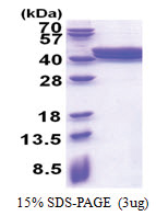 ACAD8 (23-415, His-tag) Human Protein