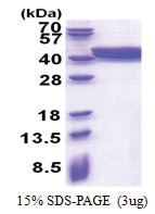 ACAD8 (23-415, His-tag) Human Protein